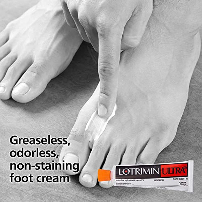 Lotrimin Ultra 1 Week Athlete's Foot Treatment, Prescription Strength Butenafine Hydrochloride 1%, Cures Most Athlete?s Foot Between Toes, Cream, 1.1 Ounce